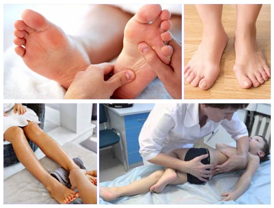 Valgus deformācija bērnu ārstēšanā