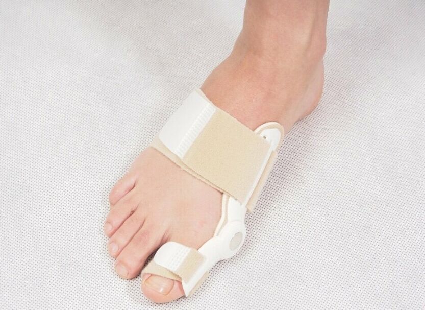 Koriģējošā korsete